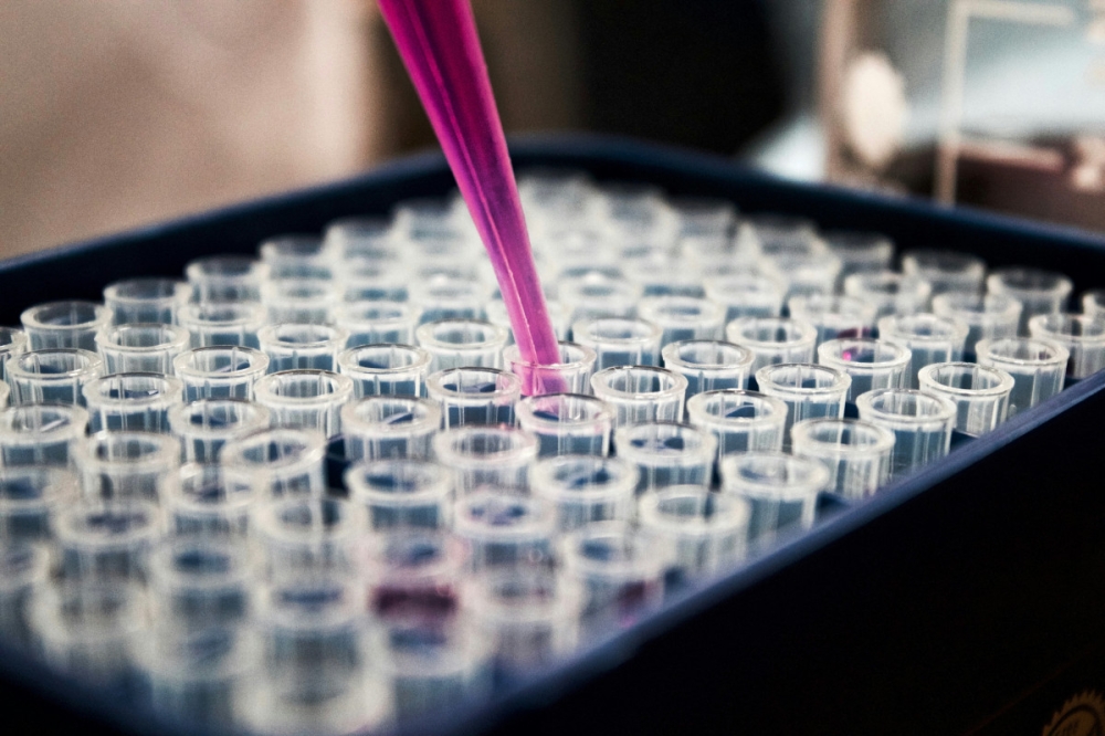 Test tubes are seen in this undated illustrative picture. — Unsplash pic