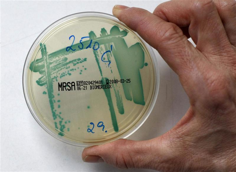 A MRSA bacteria strain seen in a petri dish containing a special jelly for bacterial culture in a microbiological laboratory in Berlin in this March 1, 2008, file photo Reuters