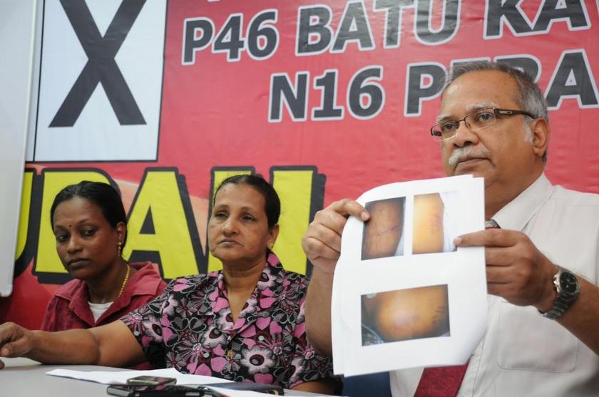 Penang Deputy Chief Minister II P. Ramasamy showing the pictures of injuries on Murugan before he died. Next to Ramasamy are Murugan's mother P. Ramyee (centre) and his wife, A. Janes Mageshwari, April 15, 2014. u00e2u20acu2022 Picture by K.E. Ooi