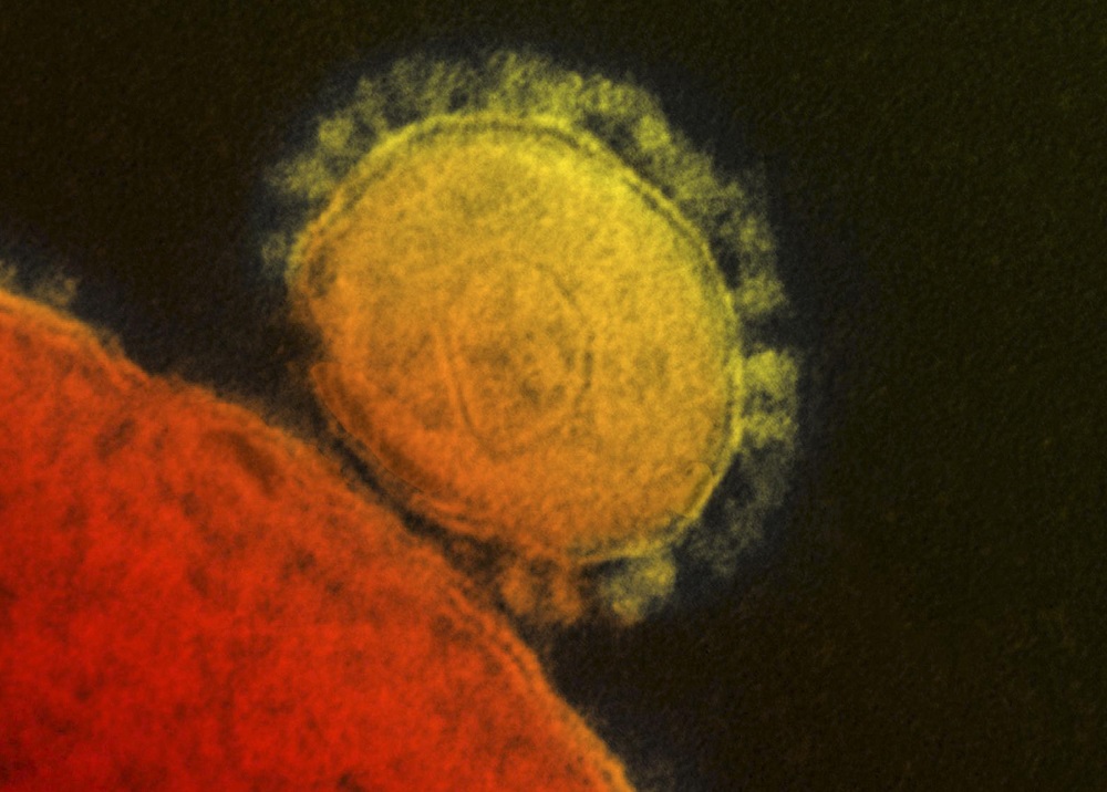 The Middle East respiratory syndrome (MERS) coronavirus is seen in an undated transmission electron micrograph from the National Institute for Allergy and Infectious Diseases (NIAID). u00e2u20acu201d Reuters pic