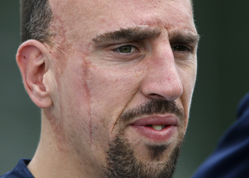 France's national soccer team forward Franck Ribery attends a training session in Clairefontaine, near Paris, in preparation for the upcoming World Cup, May 23, 2014. u00e2u20acu201d Reuters pic