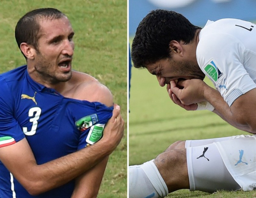 A combo of two photos taken on June 24, 2014 shows Italyu00e2u20acu2122s  Giorgio Chiellini (left) showing an apparent bite mark and Uruguayu00e2u20acu2122s  Luis Suarez (right) holding his teeth after the incident during the Group D match between Italy and Uruguay in Natal, Bra