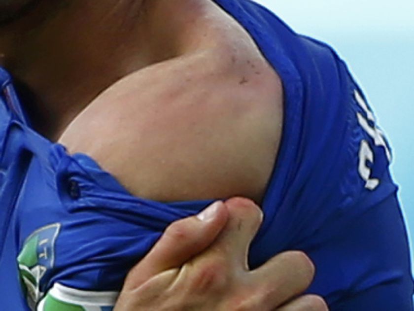 Italy's Giorgio Chiellini shows his shoulder, claiming he was bitten by Uruguay's Luis Suarez, during their 2014 World Cup Group D soccer match at the Dunas arena in Natal June 24, 2014 Reuters