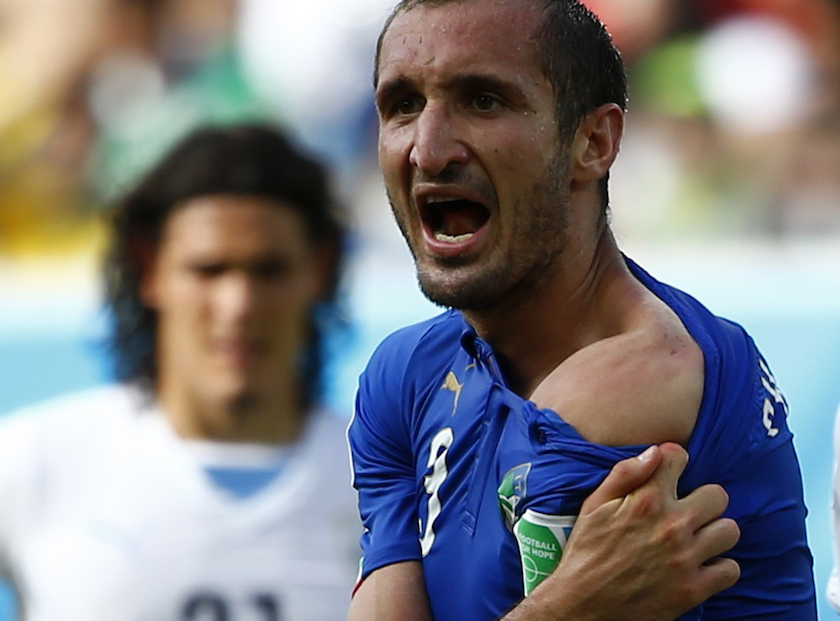 Italyu00e2u20acu2122s Giorgio Chiellini shows his shoulder, claiming he was bitten by Uruguayu00e2u20acu2122s Luis Suarez, during their 2014 World Cup Group D match at the Dunas arena in Natal June 24, 2014. u00e2u20acu201d Reuters pic