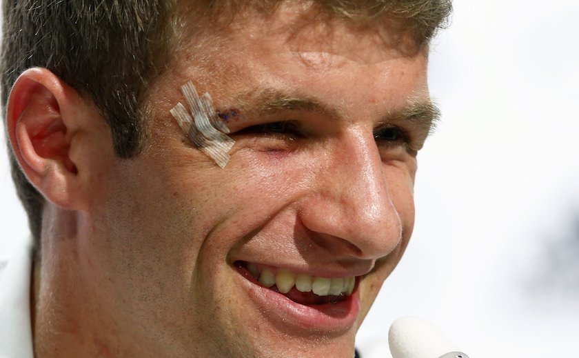 A cut beside the right eye of Germanyu00e2u20acu2122s national team player Thomas Mueller is covered with plasters as he attends a news conference in Santo Andre north of Porto Seguro June 24, 2014. u00e2u20acu201d Reuters pic