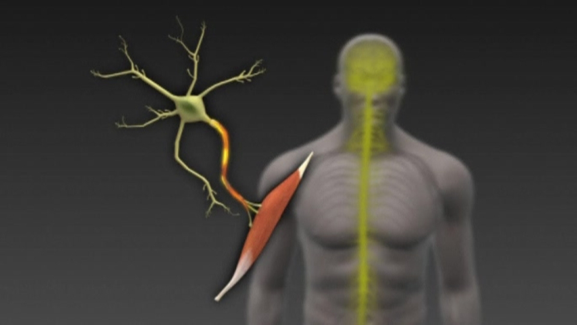 ALS: A closer look at amyotrophic lateral sclerosis (VIDEO) | Malay Mail