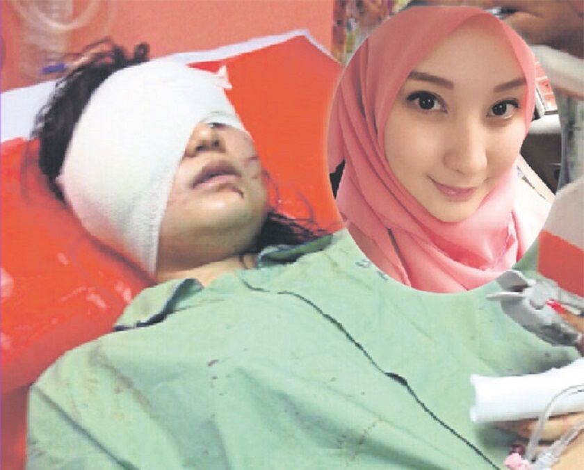 Tema suffered injuries below her right eye and cuts on her left cheek and Shafiqa (inset) suffered cuts on her face. u00e2u20acu201d Picture by Malay Mail
