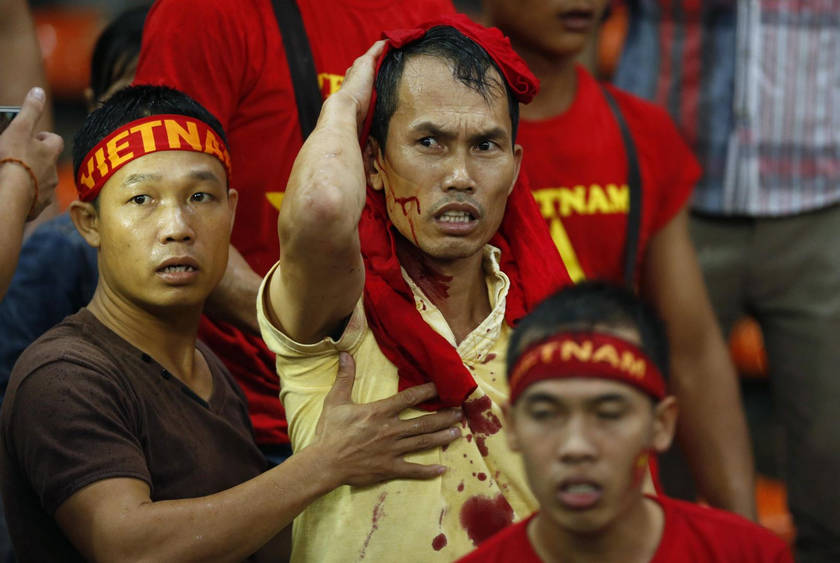 A Vietnamese fan wipes blood on his head after scuffles between fans at the Suzuki Cup semi-final between Vietnam and Malaysia at the Shah Alam stadium, December 7, 2014. u00e2u20acu201d Reuters pic