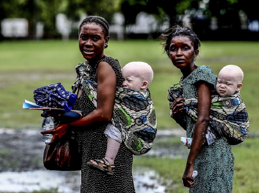 This image courtesy of the Milliyet Daily shows women carrying their albino children in Dar es Salaam, Tanzania in this May 5, 2014 file picture. u00e2u20acu201d AFP pic