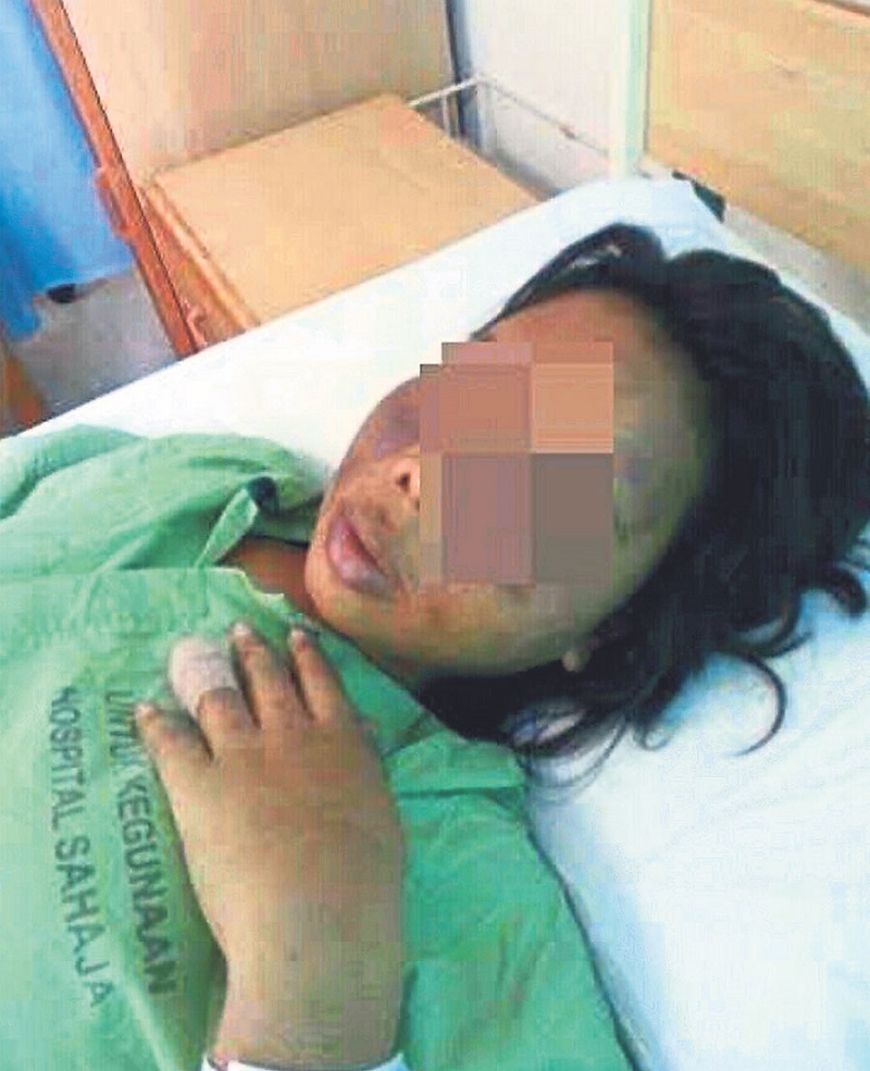 Norfia Linda recuperates at the Selayang Hospital, April 27, 2015. Her fate could have been fatal if she had not been discovered by the Orang Asli. u00e2u20acu201d Picture courtesy of the Indonesian Embassy