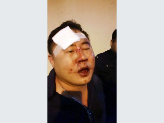 Picture allegedly shows businessman Lim Chin Huat who claims to have suffered injuries when he was restrained by Singapore police officers. u00e2u20acu201d TODAY pic