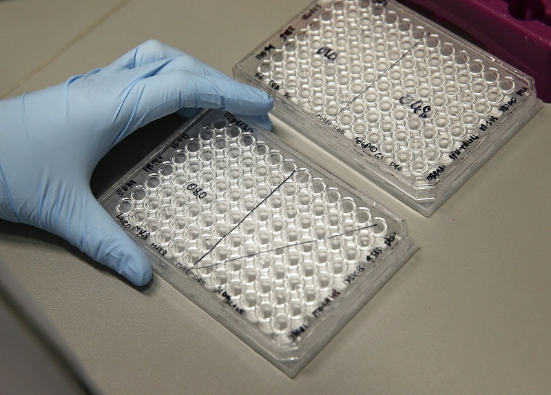 A research assistant works on a vaccine for Ebola at The Jenner Institute in Oxford, southern England in this January 16, 2015 file photo. u00e2u20acu201d Reuters pic