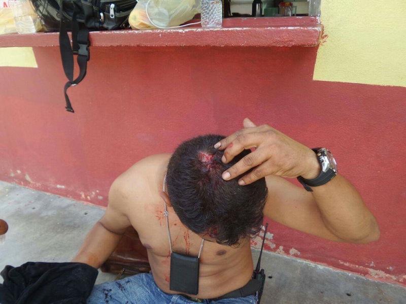 KL Express photographer Mahathir Mohammad was injured during a scuffle in Permatang Pauh on May 7, 2015.