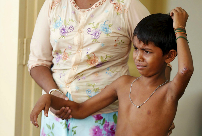 A Rohingya child arrives to be treated by a medical staff a day after landing at Pantai Pasir Berdengung beach in Langkawi Island, May 12, 2015. u00e2u20acu201d Reuters pic