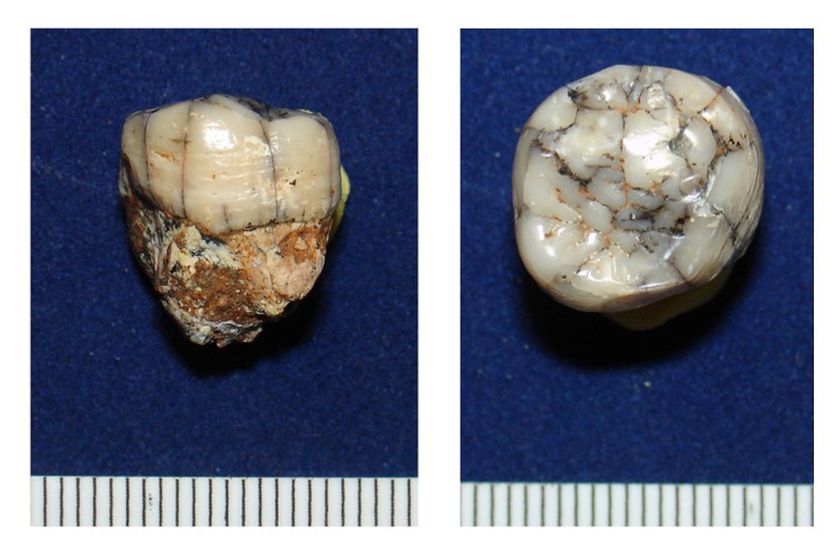 An undated picture provided by the Press Office of the Senckenberg Research Institute on January 4, 2016, shows examined tooth of Gigantopithecus from Thailand. u00e2u20acu2022 AFP pic