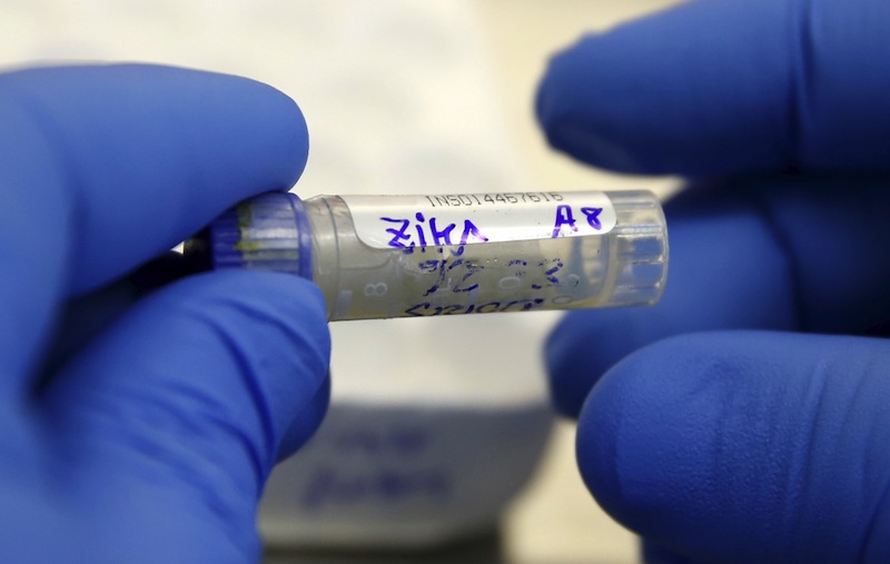 A health technician analyses a blood sample from a patient bitten by a mosquito at the National Institute of Health in Lima, Peru, February 2, 2016. u00e2u20acu201d Reuters