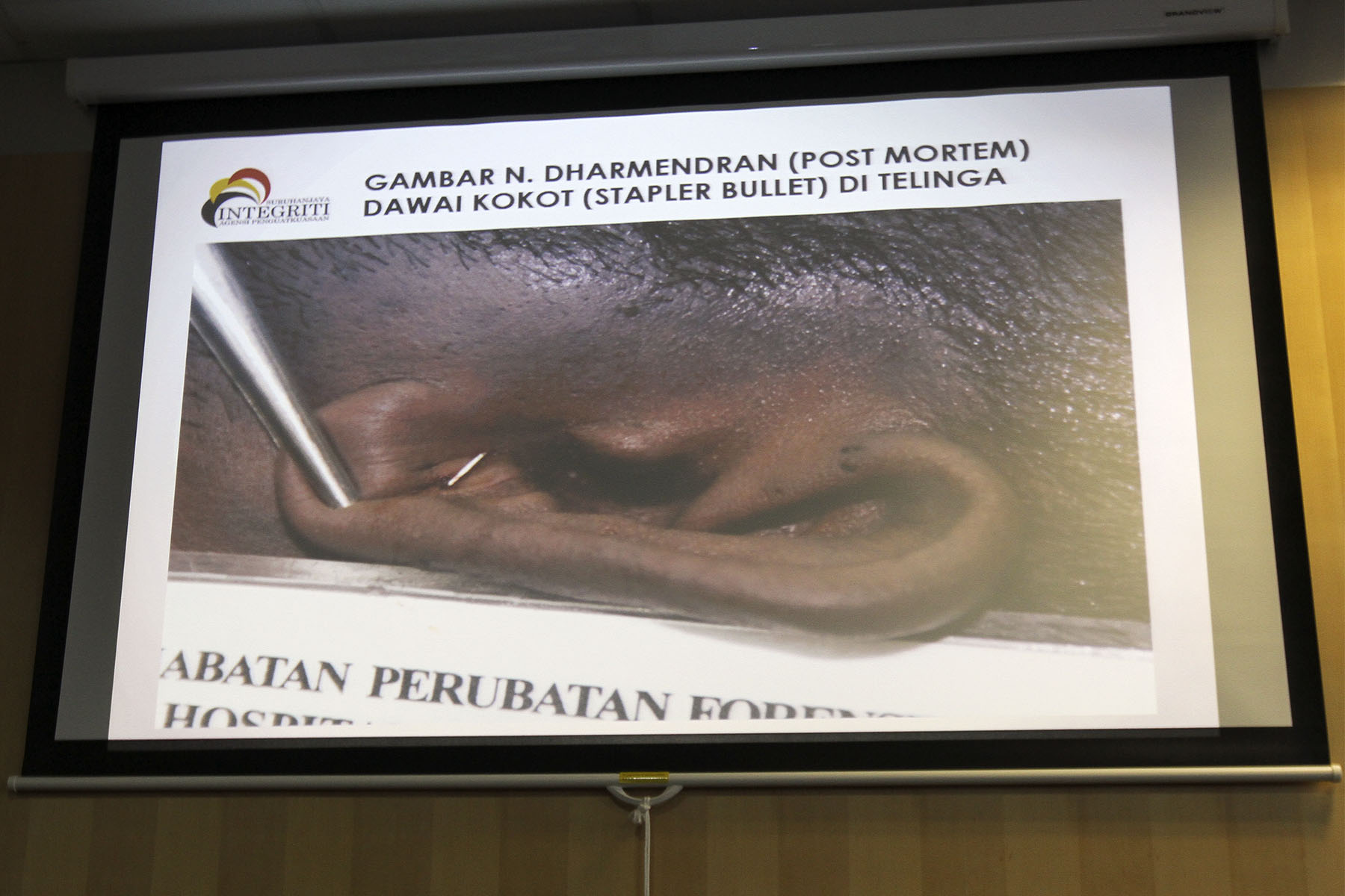 Yaacob explained that the pathologist report found that both Dharmendran's right and left ears which were stapled had blood stains on them. u00e2u20acu2022 Picture by Yusof Mat Isa