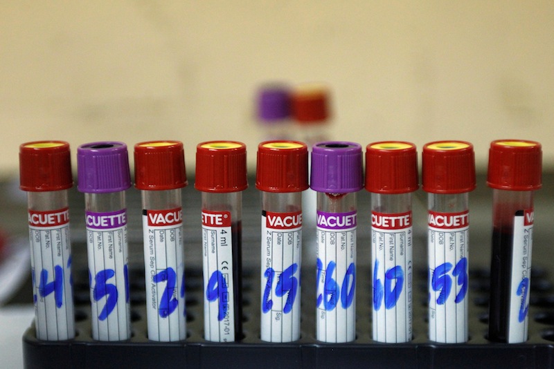 Test tubes with blood samples from patients who have been tested for Zika are seen at the maternity ward of the Hospital Escuela in Tegucigalpa, Honduras April 15, 2016. u00e2u20acu201d Reuters pic