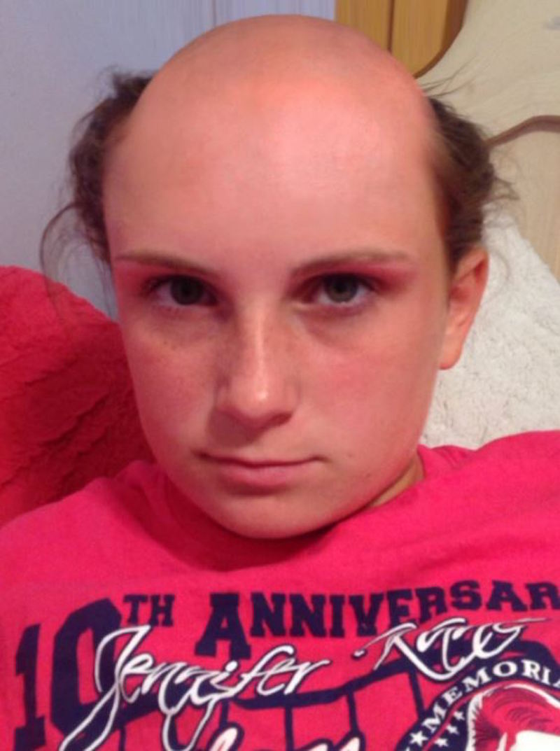 It looks like her summer might be ruined. — Picture via Twitter.com/Kaycon000 