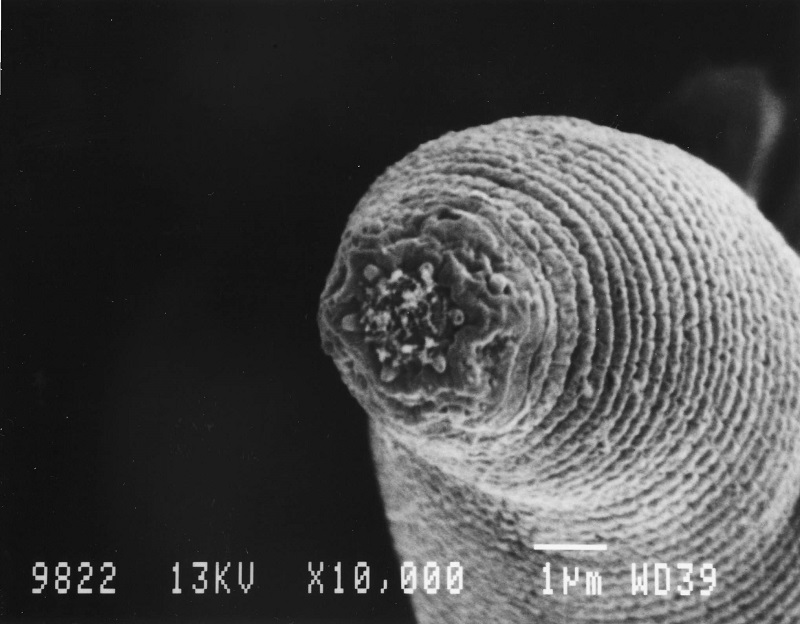 In this undated handout photo, a new species of nematode that a team of researchers discovered in the Beatrix mine near Welkom, South Africa. u00e2u20acu201d Picture by Gaetan Borgonie/University Ghent, Belgium via The New York Times