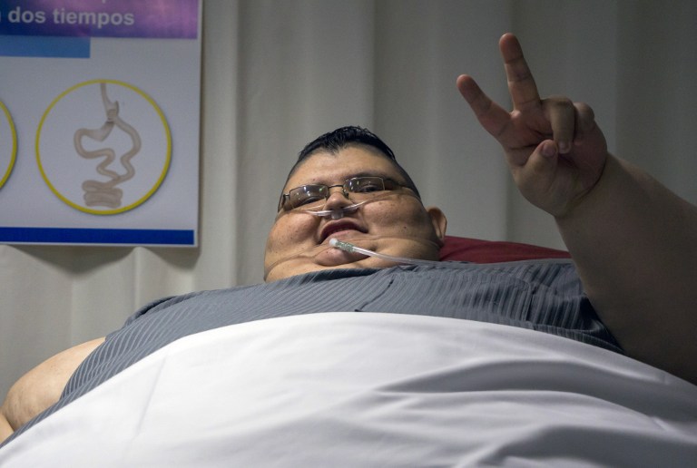 Mexican 32-year-old Juan Pedro Franco, who weighs almost 500 kilograms answers questions during a press conference at the hospital in Guadalajara, Mexico on December 21, 2016. u00e2u20acu201d AFP pic