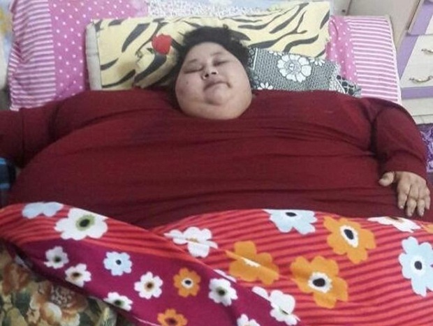 World's heaviest living woman Eman Ahmed Abd El Aty. u00e2u20acu201d Picture courtesy of Davood Eldeniz/Twitter