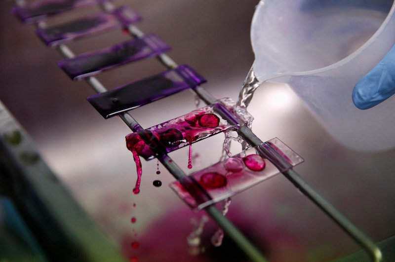 A health technician analyses blood samples for tuberculosis testing in a high-tech tuberculosis lab in Carabayllo in Lima, Peru May 19, 2016. u00e2u20acu201d Reuters pic