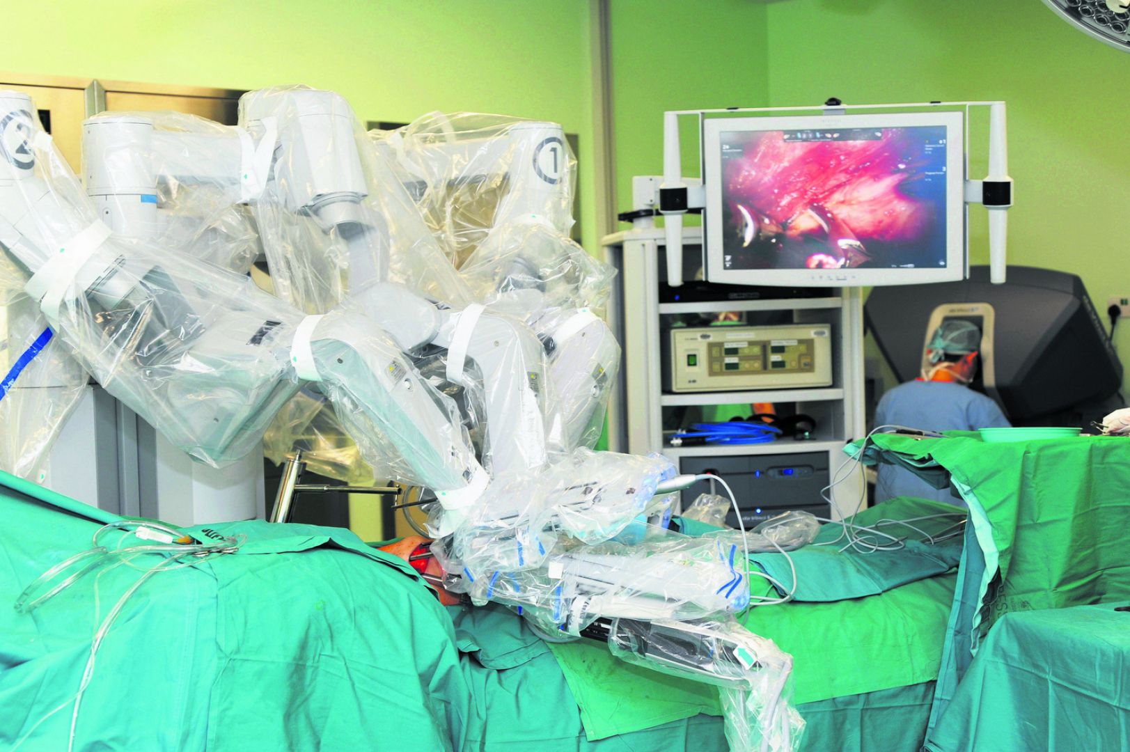 In robotic surgery, the surgeon operates in front of a monitor while seated at a console. u00e2u20acu201du00c2u00a0Picture  courtesy Singapore General Hospital 