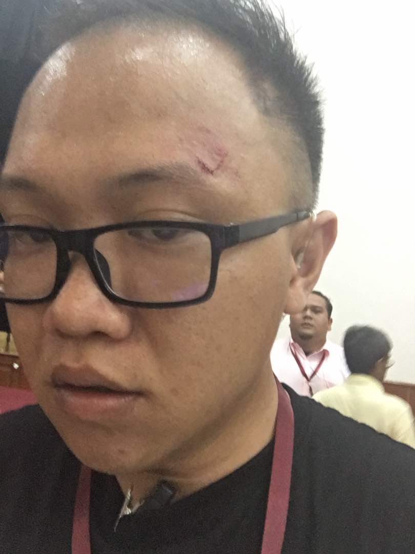 Daniel Low sustained facial injuries in his attempt to protect attendees from assailants. — Photo courtesy of DAP 