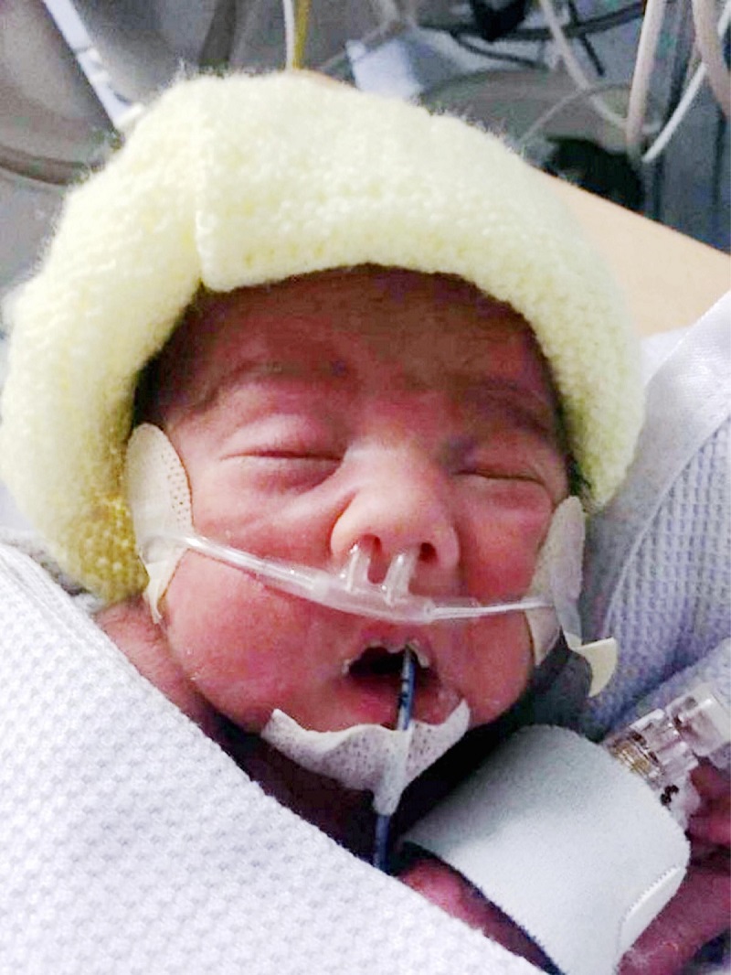 Amin was admitted to the Neonatal Intensive Care Unit (NICU) of John Radcliffe Hospital in Oxford. It was learnt the infant was fed through a tube and was experiencing breathing complications.