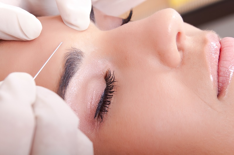 Botox has been approved by the FDA for three facial treatment areas. u00e2u20acu201d AFP pic