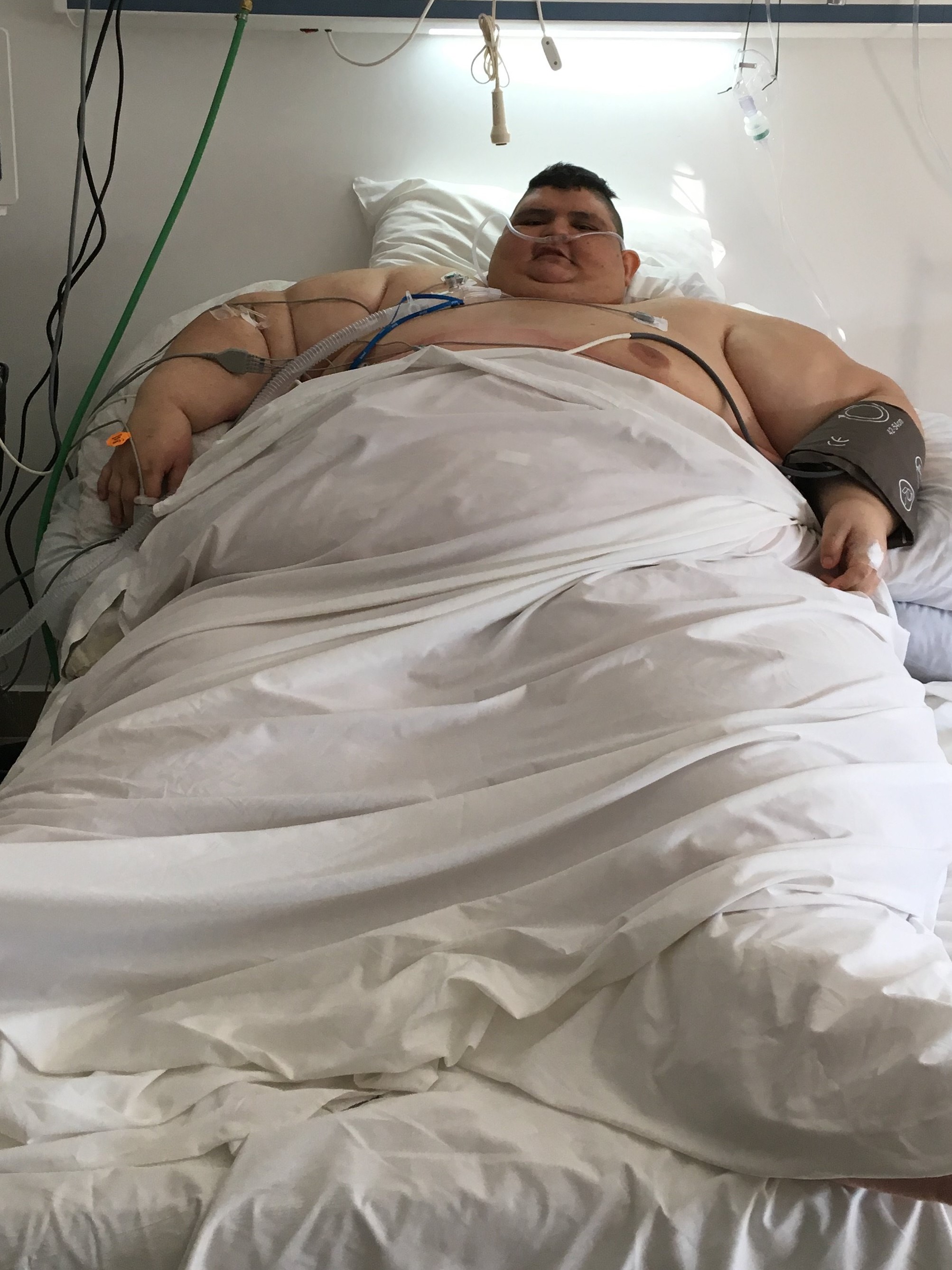 Juan Pedro Franco at the intensive care room, where he recovers after an operation to reduce weight in Guadalajara, Jalisco state, Mexico on November 23, 2017. u00e2u20acu201d AFP pic