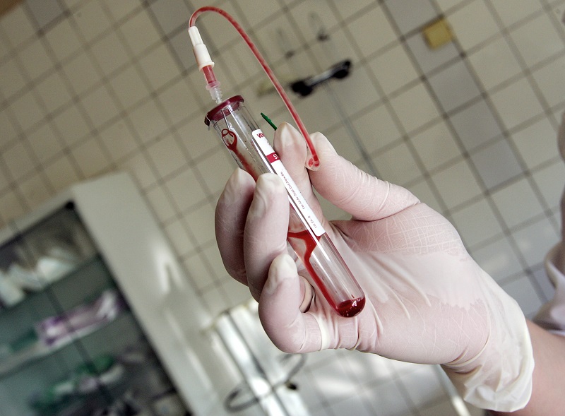 This file picture taken 19 June 2006 shows a nurse holding a test-tube with HIV positive blood in an infectious diseases hospital in Moscow. u00e2u20acu201d AFP pic