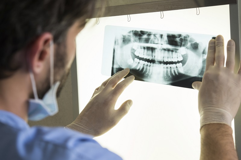 New research suggests that advanced gum disease could be linked to an increased risk of cancer. u00e2u20acu201d AFP pic