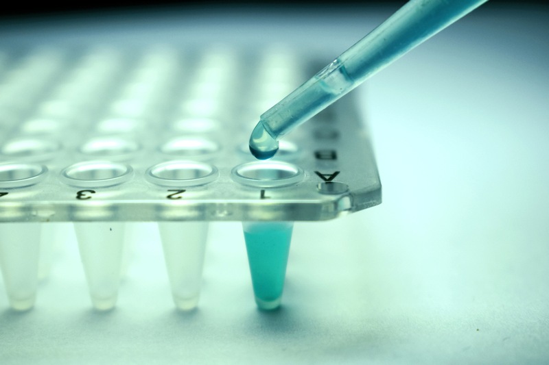 Scientists have been working on growing working muscle tissue in a lab. u00e2u20acu201d CIPhotos/IStock.com pic via AFP