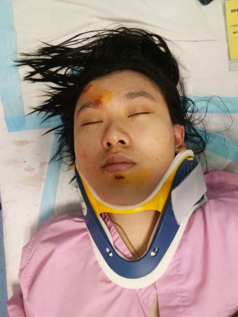 A victim said to be Chua Yennie lies in a hospital bed with a neck brace following the accident. u00e2u20acu201d Picture courtesy of PDRM