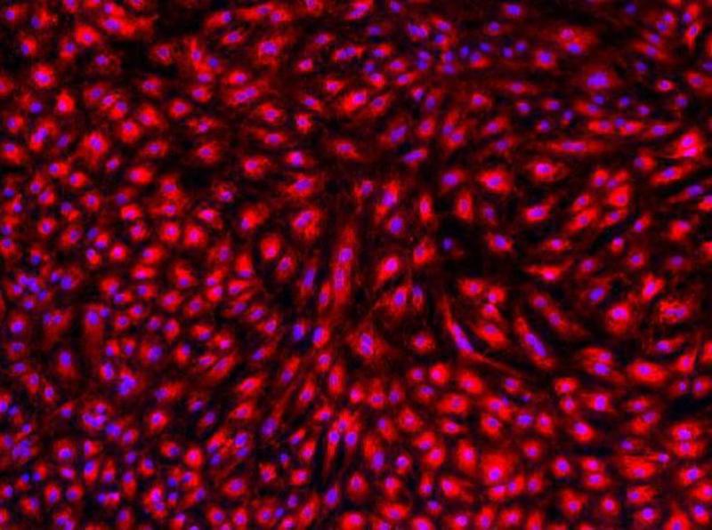 Liver cells derived from stem cells. u00e2u20acu201d Picture by A*Star's Genome Institute of Singapore via TODAY