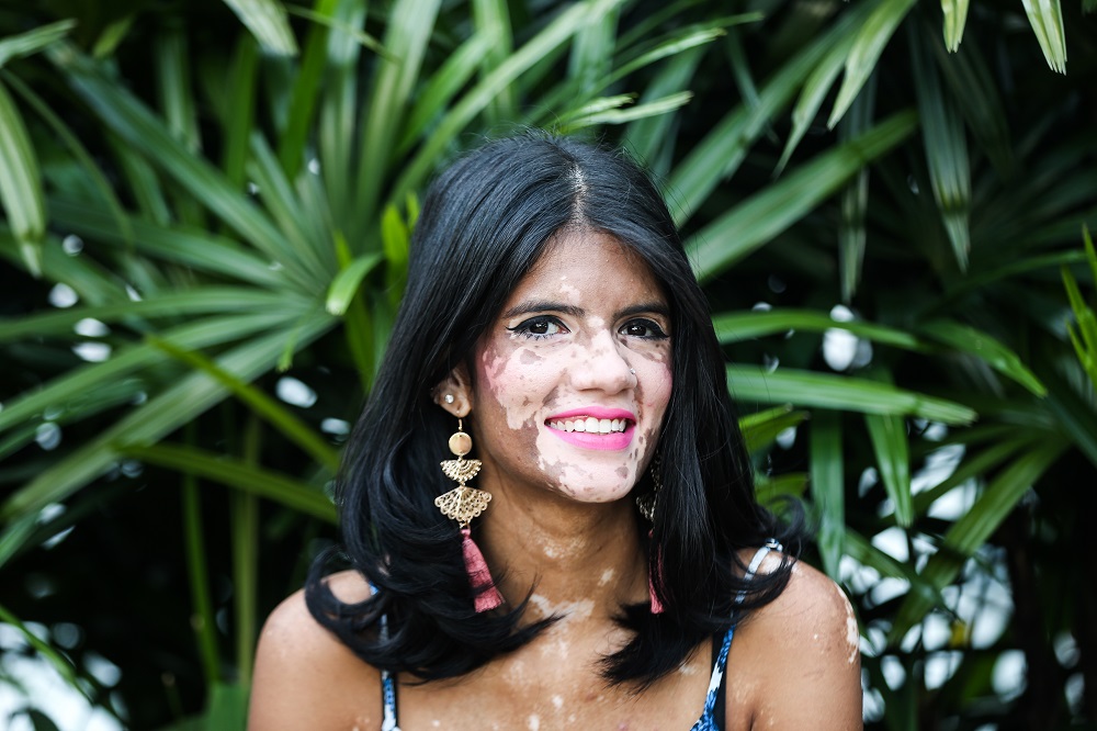 Sonya is taking on more projects in her ambition to become a modelling star. Photoshoots like this she says help break new boundaries in confidence.