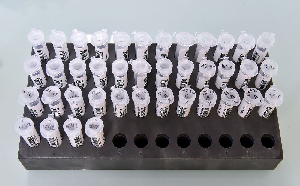 In this file photo taken on December 10, 2015 Sample of are prepared for DNA testing at the Genetic Institute Nantes-Atlantique (IGNA) in Nantes, western France. u00e2u20acu201d AFP pic