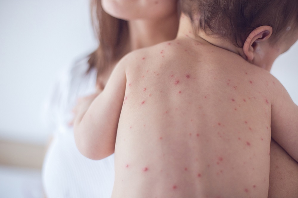 In Europe, the problem was blamed in part on complacency and misinformation about a vaccine proven to be both effective and safe. In Latin America, cases have spiked partly because of Venezuelau00e2u20acu2122s collapsing health system, experts said. u00e2u20acu201d AFP pic     
