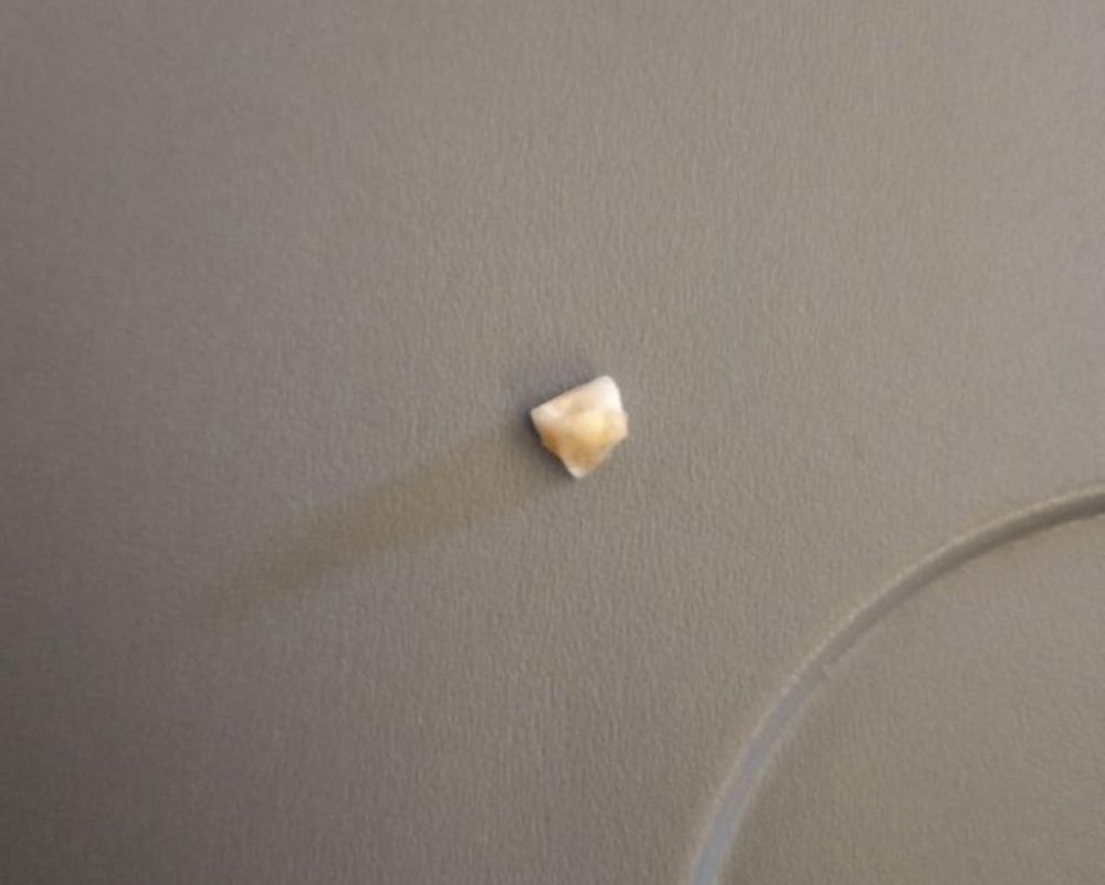News agency Australian Associated Press first reported that the passenger, Bradley Button, found a tooth that did not belong to him when eating his rice on a Singapore Airlines flight. u00e2u20acu201d Picture courtesy of Bradley Button via TODAY