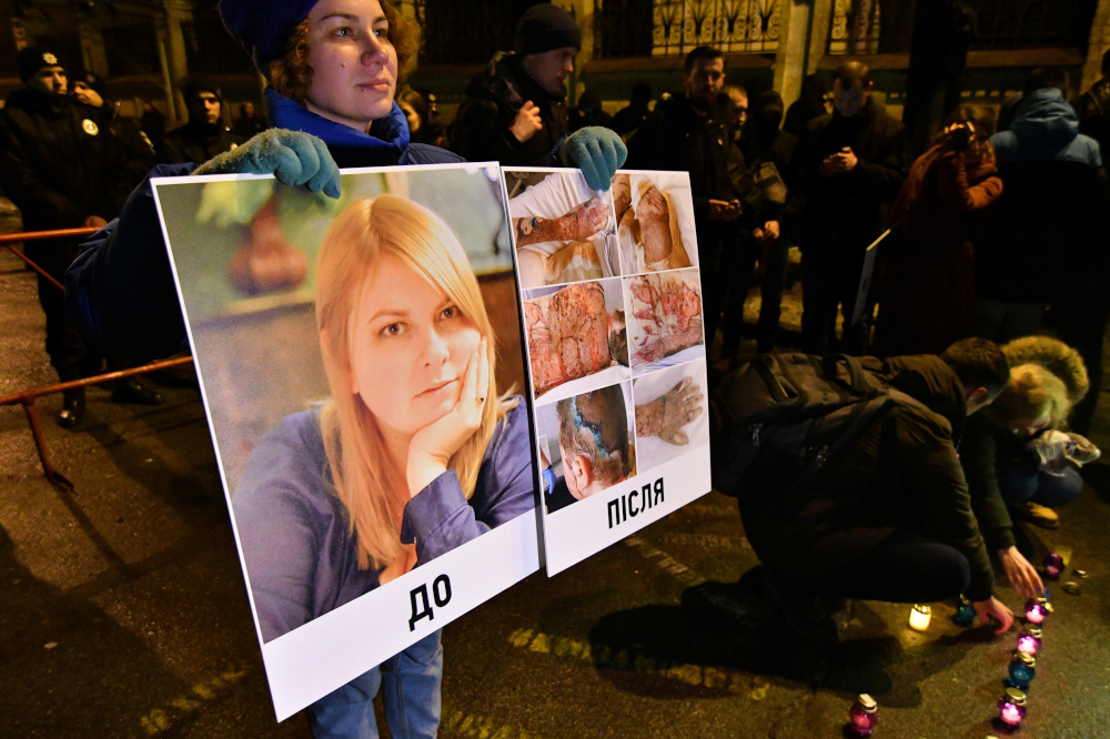 A photo taken in Kiev on February 4, 2019, shows an activist holding a portrait of Kateryna Gandzyuk and placard depicting her traumas after acid attack during a meeting in remembrance of the Ukrainian anti-corruption campaigner. u00e2u20acu201d AFP pic
