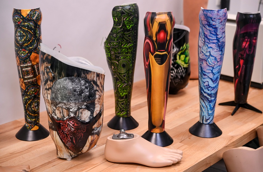 This picture taken on March 13, 2019, shows customised prosthesis displayed at ALGO, a firm specialised in prosthesis in Brest, western France. u00e2u20acu201d AFP pic  