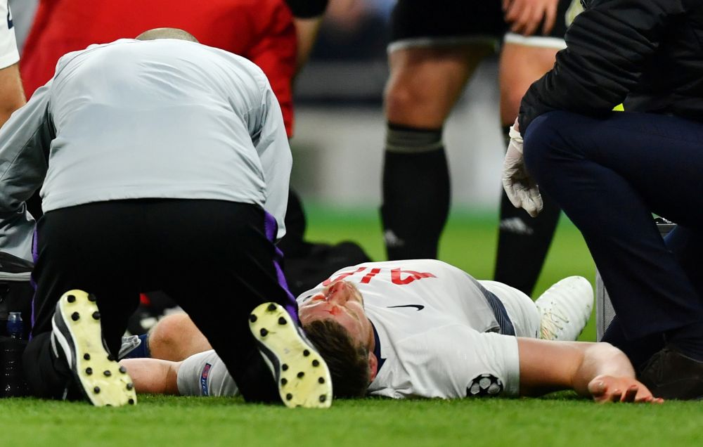 Tottenham's Jan Vertonghen receives medical attention after sustaining an injury against Ajax. u00e2u20acu201d Reuters pic