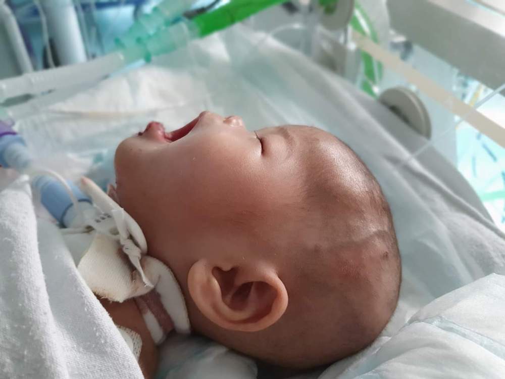 Ainul Mardhiah Ahmad Safiuddin selamat menjalani pembedahan membuang tumor di mulut di sebuah hospital di London. u00e2u20acu201d Foto ihsan Facebook/Ahmad Safiuddin