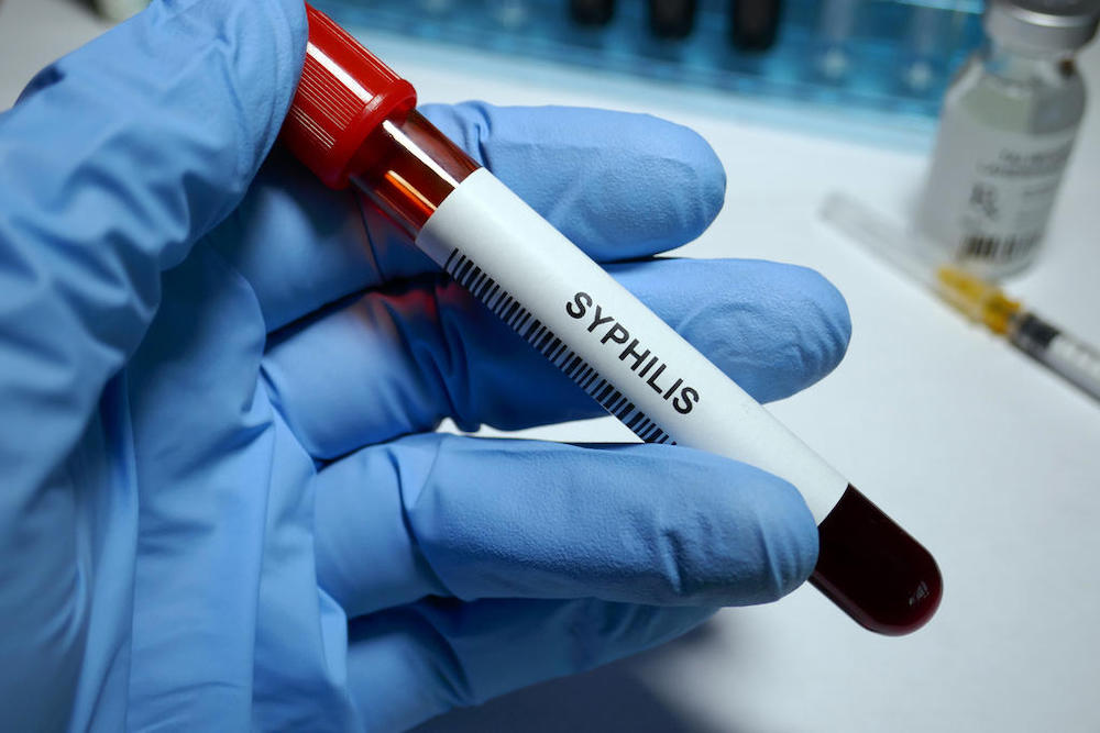 Once thought to have been nearly eradicated and a sexually transmitted disease of the past, syphilis infections are now a cause for concern. u00e2u20acu201d iStock pic via TODAY 