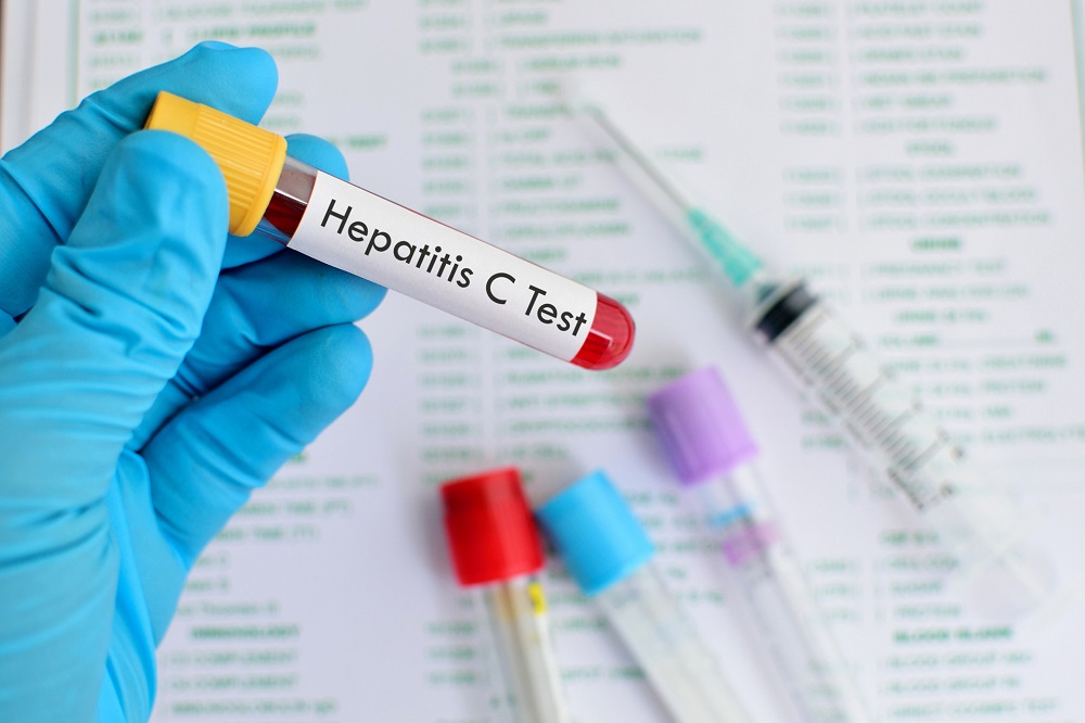 Today, July 28 marks World Hepatitis Day 2019. u00e2u20acu201d IStock/AFP Pic