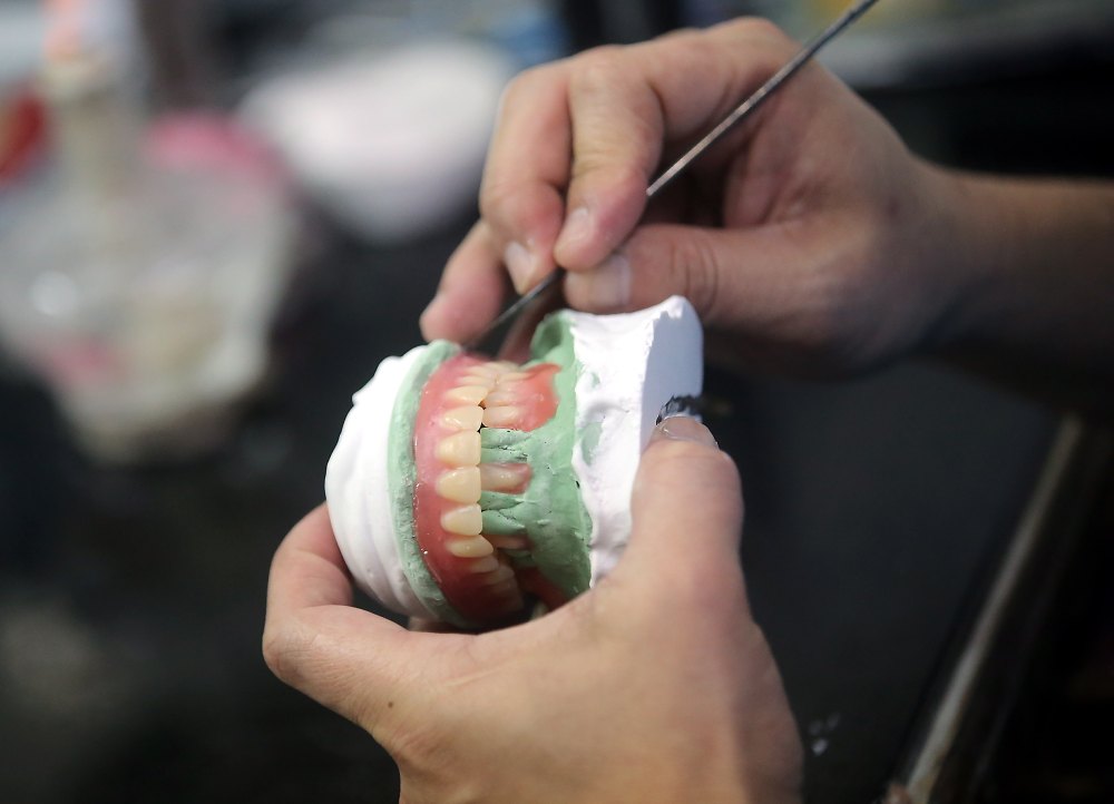 Teeth are attached with wax, with a technician shaping the wax to represent the look of the gums.