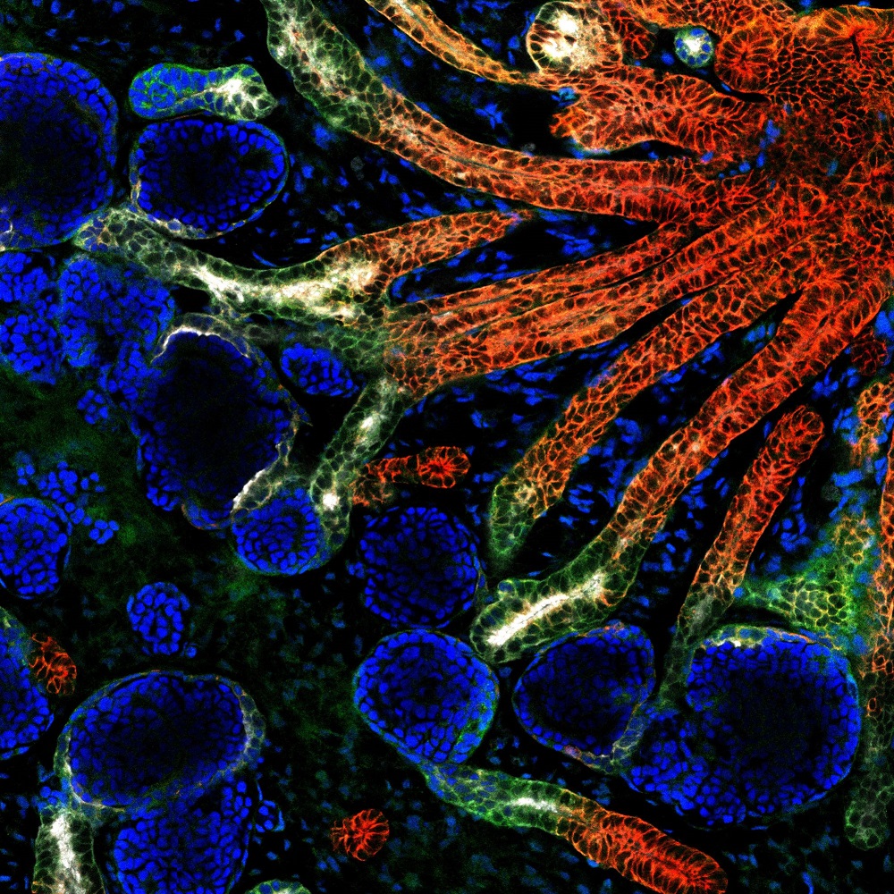 This immunofluorescence image shows the preliminary development of structures in a kidney organoid at day 24. — Picture courtesy of NTU Singapore via TODAY