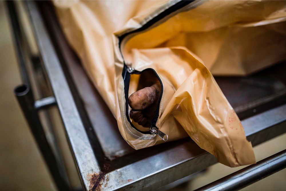 The body of an unidentified man lies on a tray at Hillbrowu00e2u20acu2122s mortuary in Johannesburg March 3, 2019. u00e2u20acu201d AFP pic